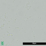 FilterStart 10 ml, Abbildung 5